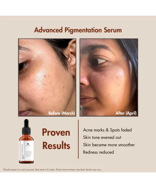 Suganda: Advanced Pigmentation Serum - 30ml