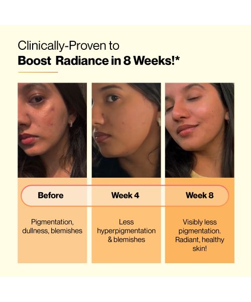 SETU: Skin Renew - 60 Effervescent Tablets | Glutathione With Vitamin C, Gluta Fizz, Supports Detoxification, Sugar-Free | Orange Flavour