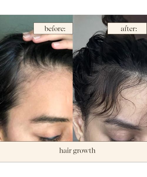 Inde Wild: Moonlight Scalp Serum with Moringa, Bhringraj & Amla for Regrowth, Healthy Scalp & Hair Density (50ml)