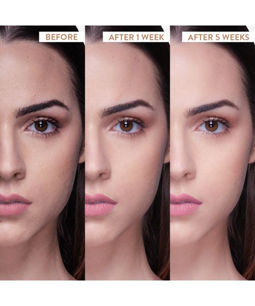 Belora: African Pink Smoothie ScrubFace Scrub - 50gm