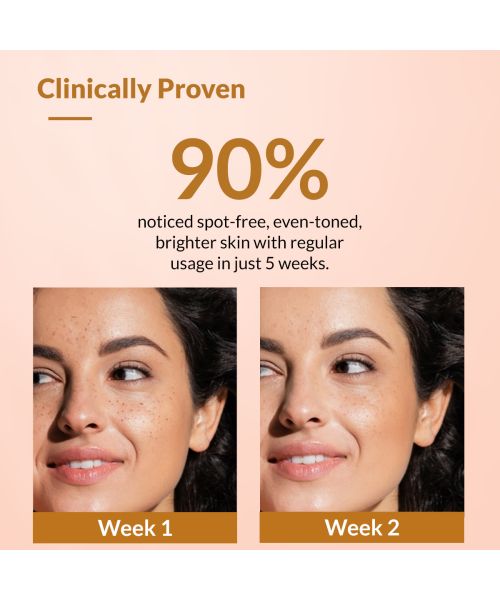 Fixderma: Kojic Acid + Arbutin Skarfix-Plus Cream - 30gm