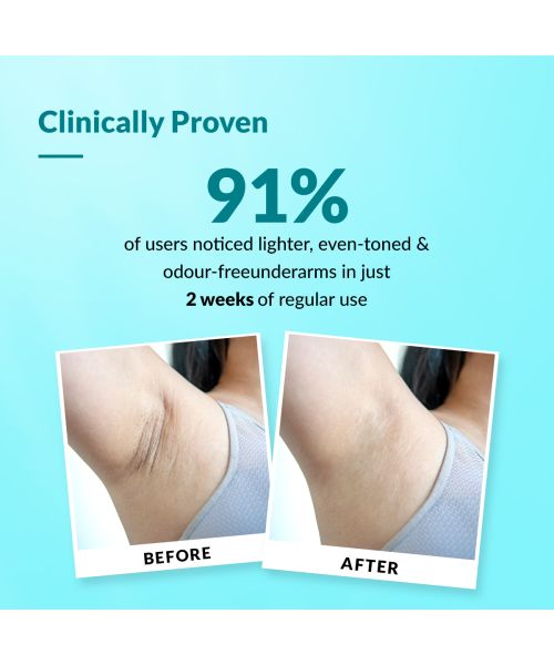 Fixderma: Nigrifix Underarm Roll on with Lactic & Kojic Acid -  60ml