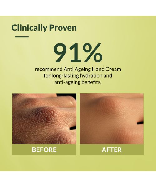 Fixderma: Anti Ageing Hand Cream Dry and Rough Hands  - 30g