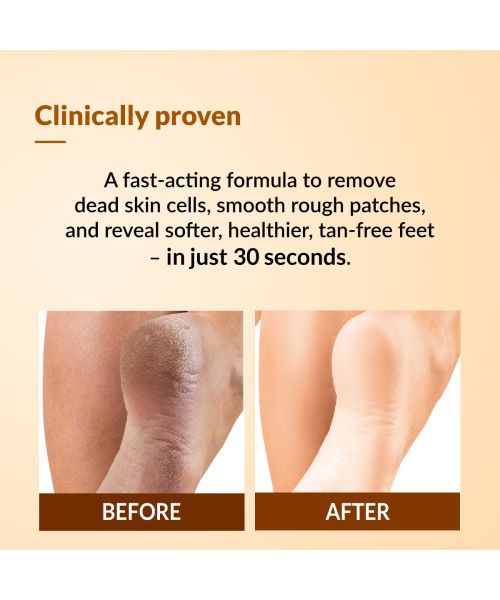 Fixderma: Foobetik Foot Scrub Spray with Lactic Acid 30 sec Scrubber -  50ml