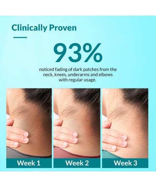 Fixderma: Nigrifix Cream for For Dark Body Parts - 50g