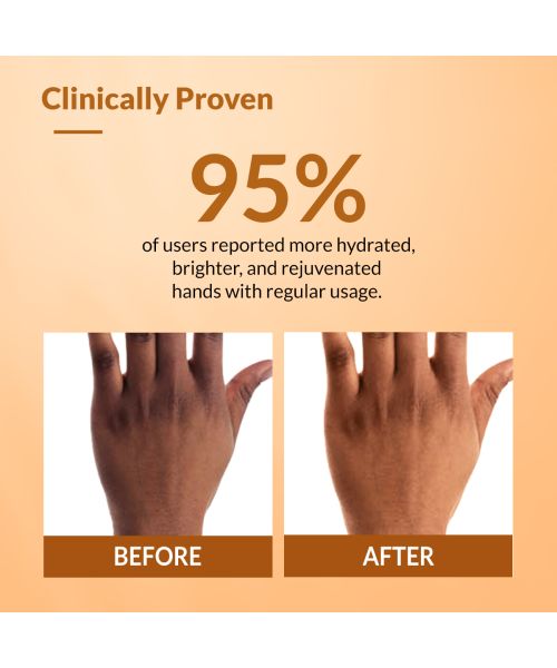 Fixderma: Hand Cream for Dry and Rough Hands  - 30g