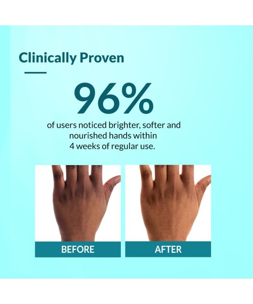 Fixderma: Brightening Hand Cream Kojic Acid Cream - 30gm