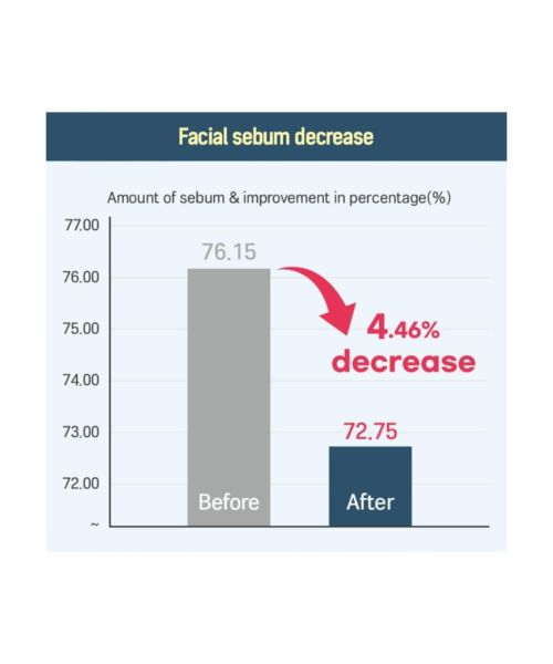 Round Lab: 1025 Dokdo Toner  200ml