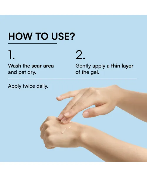 Brinton: Keloscar Gel  15gm