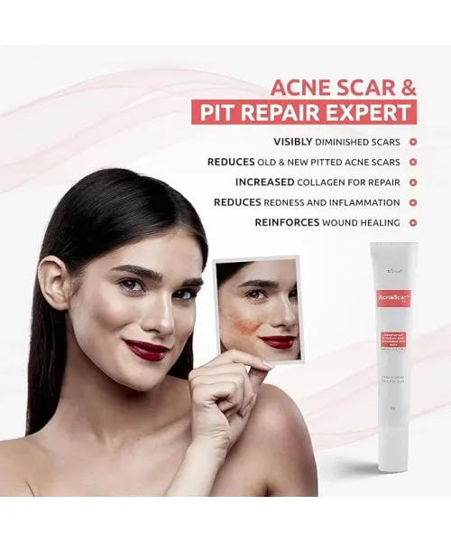 Brinton: Acnescar Gel  15gm