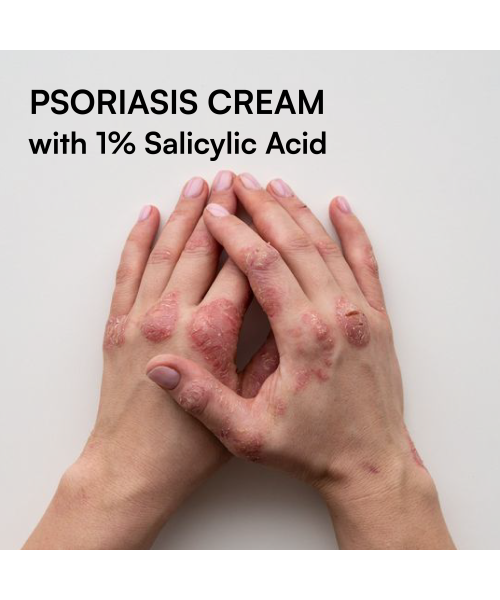 Brinton: Psoramist Moisturizing Cream  150gm