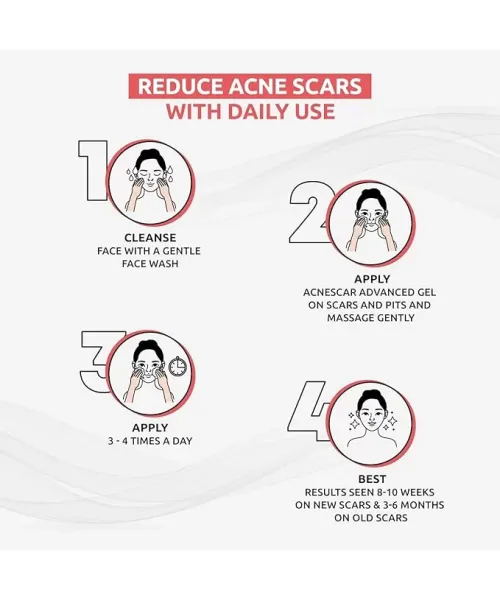 Brinton: Acnescar Gel  15gm