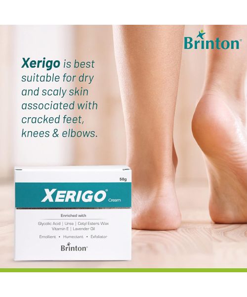 Brinton: Xerigo Cream 50gm