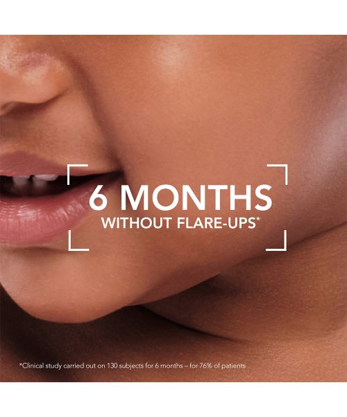 Bioderma: Atoderm Intensive Baume Ultra-soothing Balm Very dry, Sensitive to Atopic Skin, 75ml