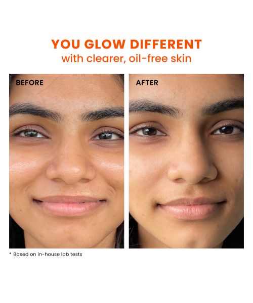 Foxtale: SPF 70 Gel-Cream Sunscreen for Oily Skin with PA++++ & Niacinamide   50ml