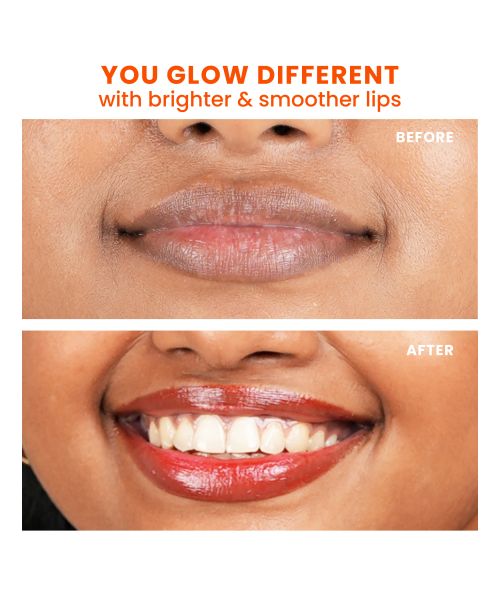 Foxtale: Brightening Lip Balm With Peptides, Vitamin C & Hyaluronic Acid - Ruby Glaze   12ml