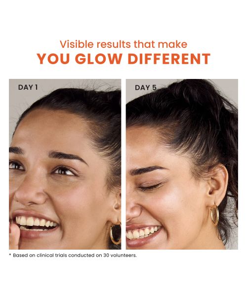 Foxtale: Brightening Vitamin C Face Serum With L-Ascorbic Acid And Vitamin E For Glowing Skin   30ml