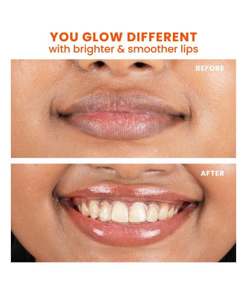 Foxtale: Brightening Lip Balm With Peptides, Vitamin C & Hyaluronic Acid - Clear Glaze  12ml