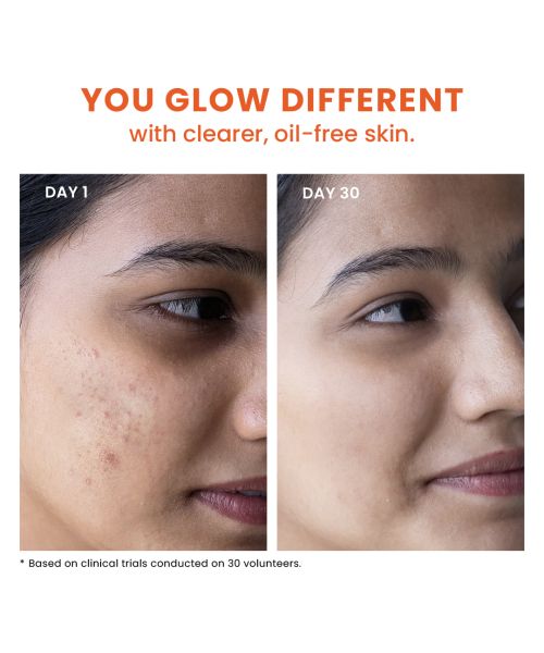 Foxtale: Acne Control Cleanser with Salicylic Acid & Niacinamide   100ml