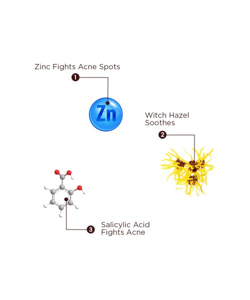 The Skin Story: Pimple Spot Corrector & Optimiser Gel - 25gm