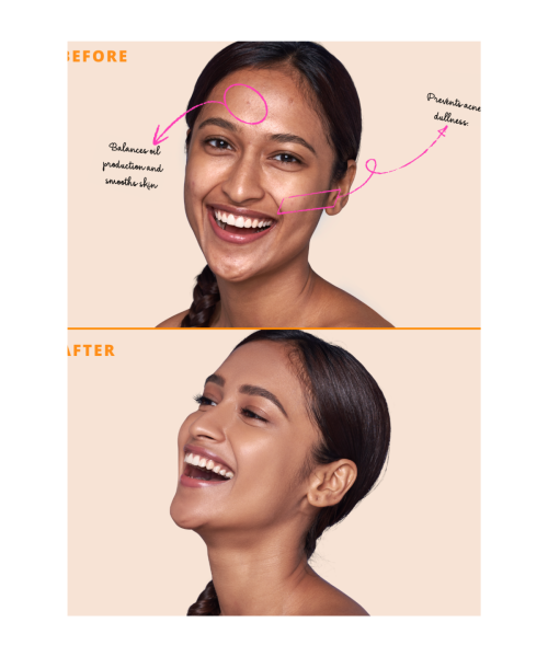 Type Beauty: Matte Up Serum Foundation For Oily & Acne Prone Skin Spf 50, Pa++++ - Waffle - 30Ml