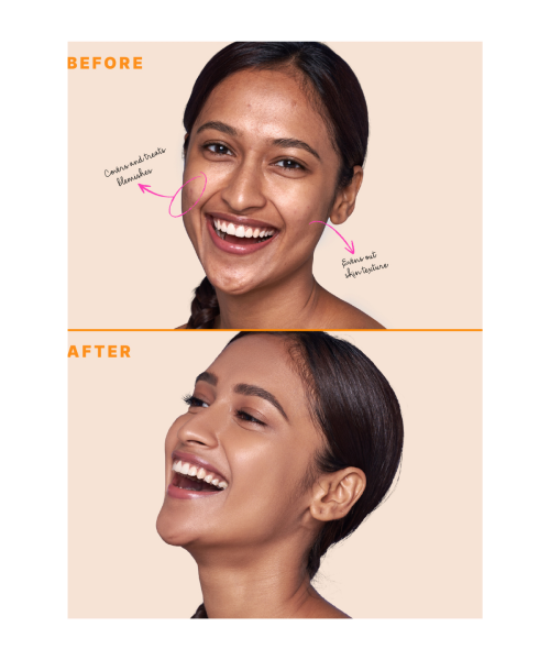 Type Beauty: Zit Quit Concealer, For Acne & Uneven Texture - Mocha - 8Ml