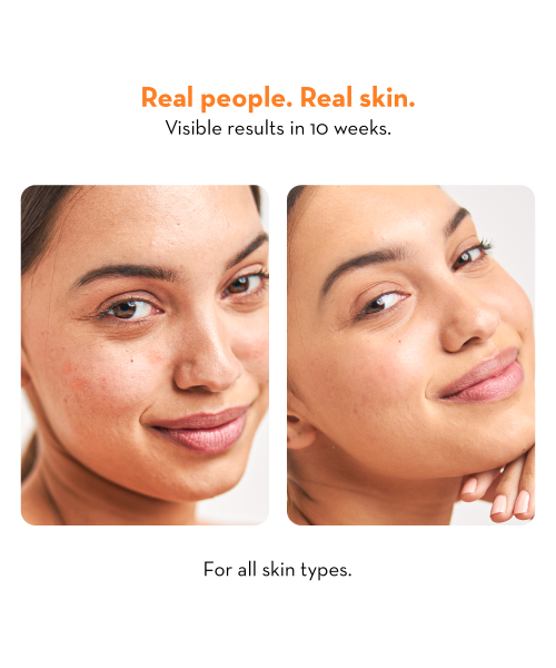 Plush: High on Collagen Gentle Face Wash with Niacinamide - 100ml