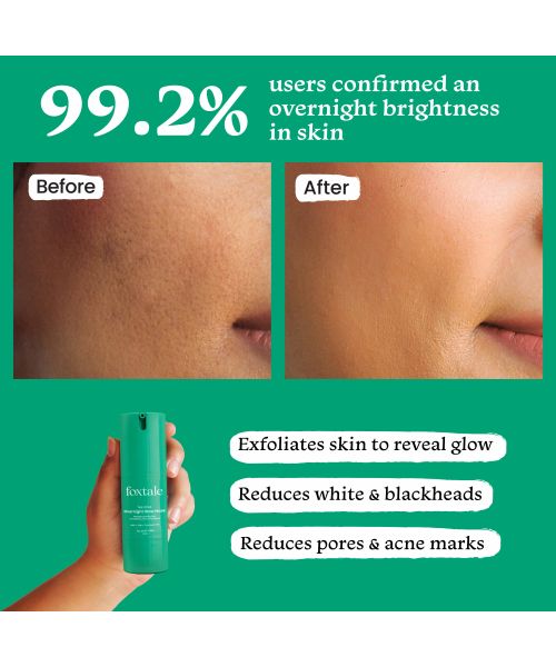 Foxtale: Overnight Glow Mask With 4% Glycolic Acid & 3% Lactic Acid    30ml