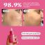 Foxtale: The Milky Way Rapid Spot Reduction Drops - 30ml