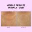 VariHope: Biotics Firming Neck Wrinkle Patch - 5 Patches