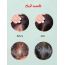 Orgatre: Acne Control Face Serum - 30ml