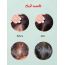 Orgatre: Acne Control Face Serum - 30ml