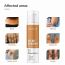 Dermatouch: Bye Bye Nigricans Cream - 50gm