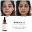 Suganda: 5% Niacinamide Serum - 30ml