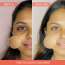 AULI: Pomoglow Pomegranate and Vitamin C Blast Gel - 50gm