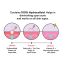 Gush: Dart It Hydrocolloid Pimple Patches- Transparent