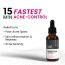 Thriveco: Goodbye Acne Serum, 30 ml
