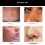 Thriveco: Goodbye Acne Cleanser, 100 ml