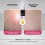 Thriveco: Stretch Mark Expert Serum Cream - 30ml