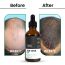 Thriveco: Hair Gowth Serum - 50ml