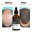 Thriveco: Hair Gowth Serum - 50ml