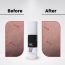 Thriveco: Stretch Mark Expert Serum Cream - 30ml