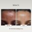 The FormulaRX: 6% AHA BHA Exfoliator (5% Glycolic & 1% Salicylic Acid) Exfoliating Serum For Whiteheads, Enlarged Pores, Dark Spots