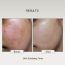 The FormulaRX: 2% BHA Exfoliator- Salicylic acid + Niacinamide - 100ml