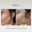 The FormulaRX: Air Brush Facial - All In One 10% Lactic Acid Exfoliating, Glowing & Brightening Serum For all skin types