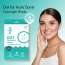 Bake Cosmetics: 2% Salicylic Acid Pimple Patches for Active Acne & Acne Prone Skin With Hydrocolloid Waterproof Patches -Pack of 36