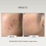 The FormulaRX: Gentle Retinol Complex Serum - Renaissance - for fine lines, wrinkles, hyperpigmentation, acne, & enlarged pores