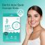 Bake Cosmetics: 2% Salicylic Acid Pimple Patches for Active Acne & Acne Prone Skin With Hydrocolloid Waterproof Patches -Pack of 144