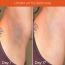 Skinvest: Light it up Sunscreen body spray - SPF 40 PA ++++ 100ml | with Kumkumadi Tailam | De-tans & Hydrates | Brightens Skin Tone | Removes Pigmentation | For All Skin Types | No white cast | No alcohol | Dermatologist Tested