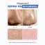 One-Day's You
: P.Z. SSOC SSOC No More Blackhead